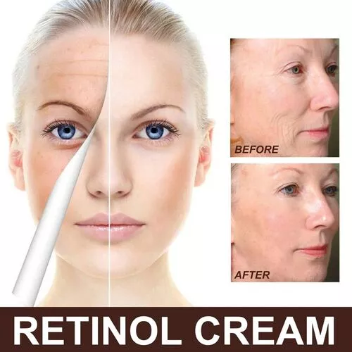 Retinol Cream